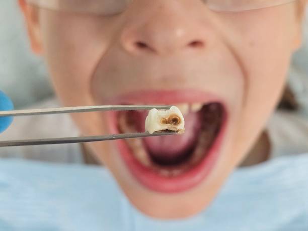 Professional Emergency Dental Service in WI